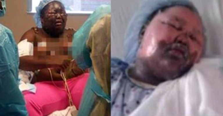 Significant Development Following “Hot Water Challenge” Joke That Sends Girl To Hospital