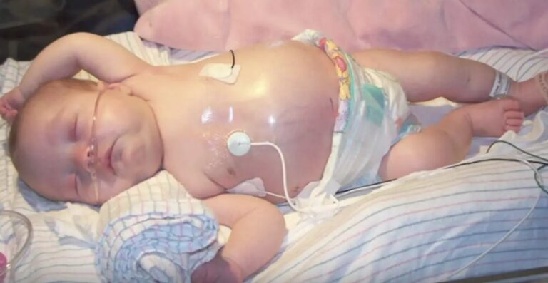 Doctors Find A Growth In Baby’s Stomach, Discover The Same Thing In Twin Sister