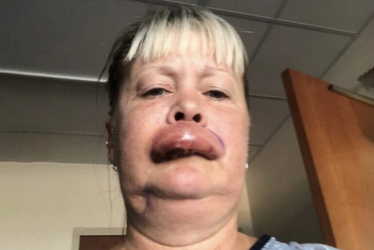 When doctors told this woman why her lip was swelling up and weren’t sure if she was going to make it, she prayed for one thing!