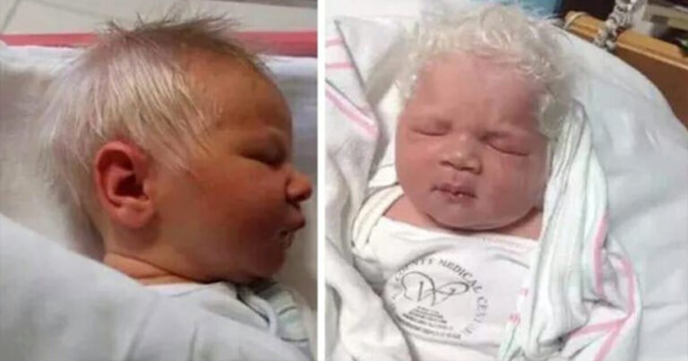 Baby Is Born With Head Full Of Gray Hair, Doctors Finally Realize Why