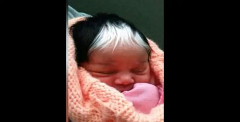 Baby Born With Unique White Streak Through Hair Just Like Her Mom