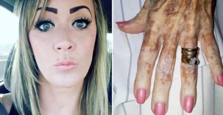 Elderly Lady Is Ashamed Of Her ‘Ugly’ Hands, Until A Nurse Explains Their Beauty