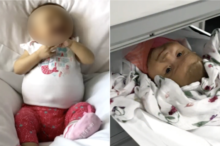 Parents in Panic as Baby’s Belly Keeps Growing – What the Doctor Revealed Will Send Shivers Down Your Spine!