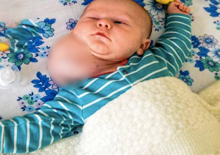 Giant lump left desperate mom fearing the worst and thinking her baby had a second head, ‘then doctors made a troubling discovery’!