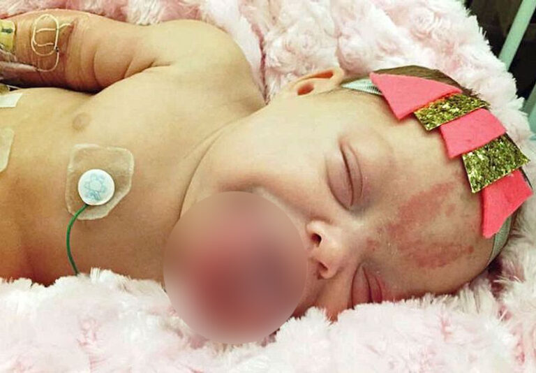 Baby was born with a huge tongue, ‘but wait until you see what the doctors did’!