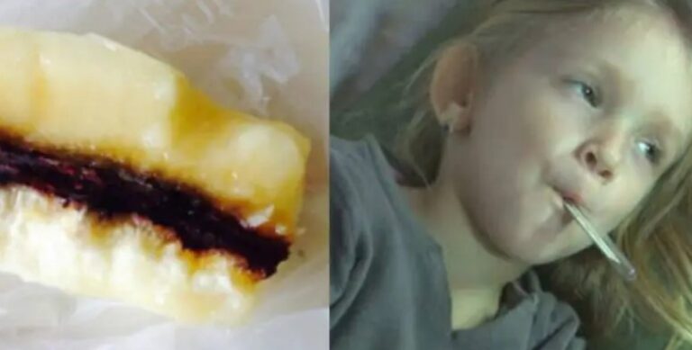 Girl Falls Deathly Ill After Eating Banana With Red Streaks Inside