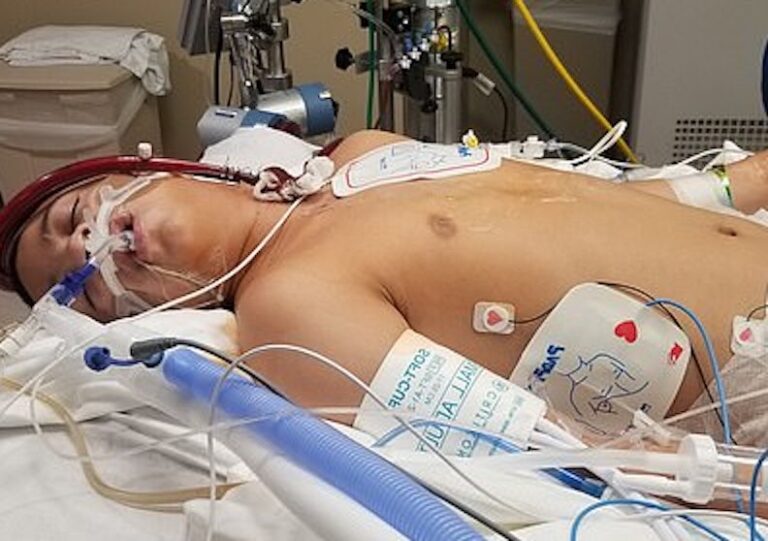 13-year-old boy was left in coma fighting for his life and permanently brain-damaged after ‘his friends forced him to do this’!