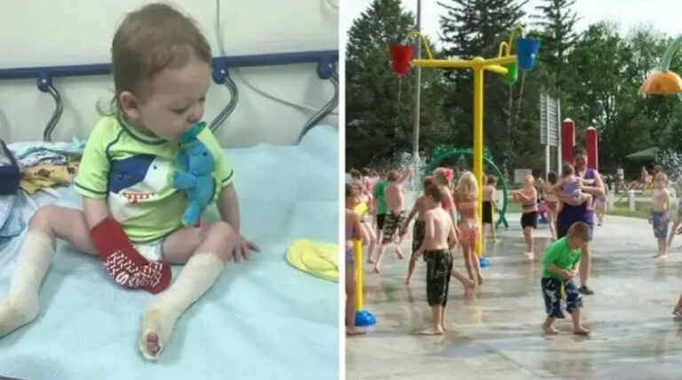 Dad Says Son’s Feet ‘Melted’ After Playing At A Splash Pad