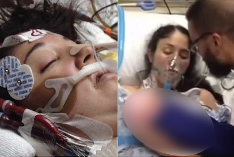 Mom went into coma after c-section and doctors put her on ‘last chance’ ventilator, but nurse’s idea changed everything!