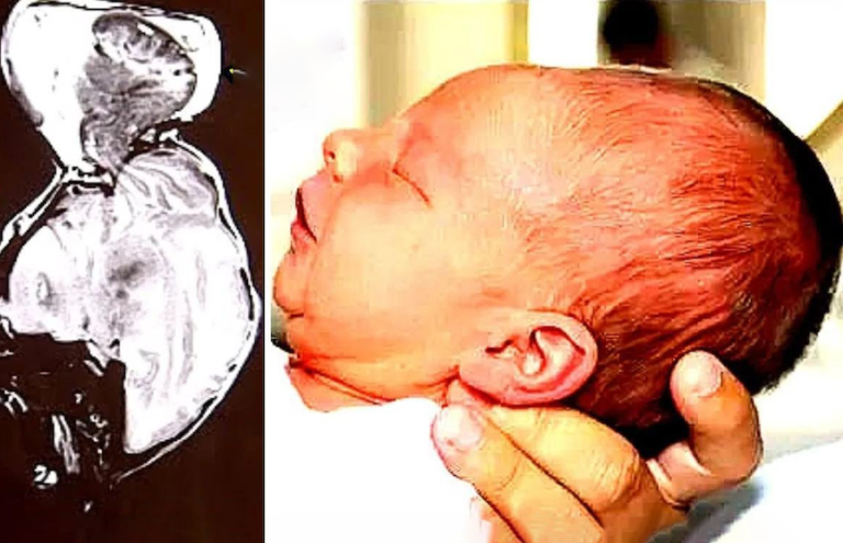 Doctors saw something coming out of baby’s head; ‘when they realized what it was, it left them in disbelief’!