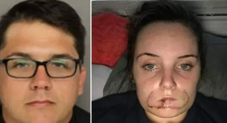 Man Bites Off Ex-Girlfriend’s Lip Because He Wants To ‘Leave His Mark’ For Her Next Boyfriend