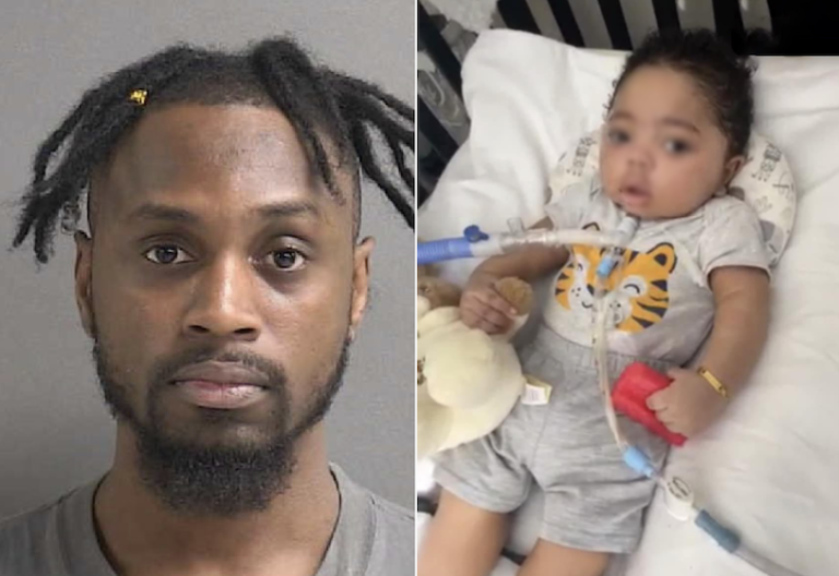 Father Shakes 3-Month-Old, Leading to 16-Minute Cardiac Arrest; 11-Month-Old Remains on Life Support