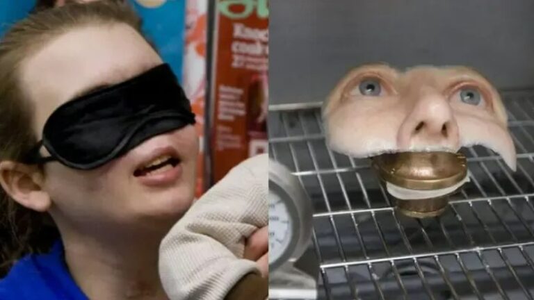 Teen Famous For Surviving Shotgun Accident Removes Mask To Show Infant Son Her New Face